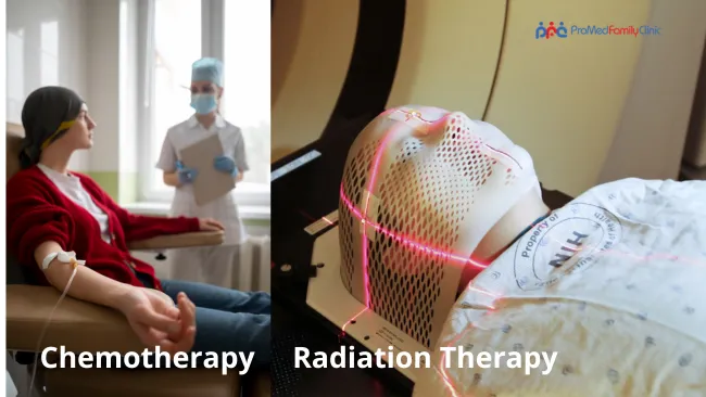 Chemotherapy, Radiation Therapy